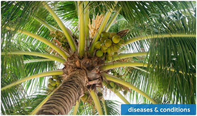 coconut oil for diseases & conditions
